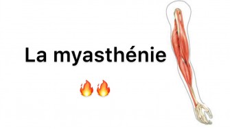La myasth&eacute;nie