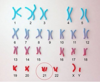 La trisomie 21 corrig&eacute;e en laboratoire