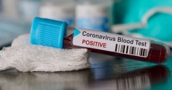 Bilan COVID-19 de la semaine du 10-16 Avril 2022