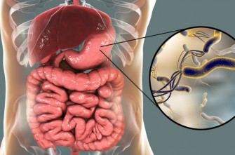 Helicobacter pylori et cancer gastrique 