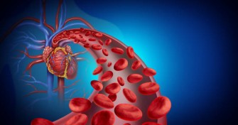 Am&eacute;liorer une mauvaise circulation sanguine