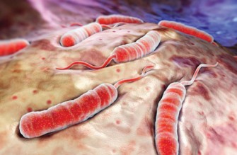 Chol&eacute;ra : toutes les r&eacute;ponses &agrave; vos questions