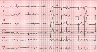 Le big&eacute;minisme