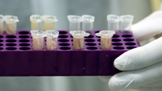 Nouveaux g&egrave;nes impliqu&eacute;s dans les tumeurs sporadiques du cancer m&eacute;dullaire de la thyro&iuml;de