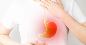 Att&eacute;nuer les remont&eacute;es acides