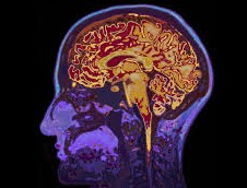  Maux de t&ecirc;te  quand sinqui&eacute;ter ?