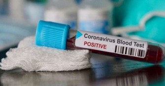 Bilan COVID-19 de la semaine du  06-12 F&eacute;vrier 2022