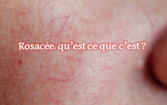 Rosac&eacute;e