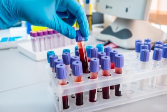 Un test sanguin d&eacute;tecte 8 types de cancers avant lapparition des sympt&ocirc;mes