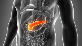 Le pronostic des ad&eacute;nocarcinomes du pancr&eacute;as sur TIPMP n&rsquo;est meilleur qu&rsquo;en l&rsquo;absence d&rsquo;envahissement ganglionnaire.