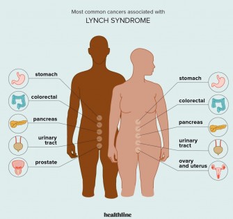 Syndrome de Lynch
