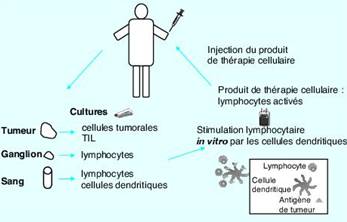 la thérapie par injection de cellules dendritiques dans le traitement des cancers
