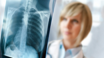 Cancers primitifs multiples de si&egrave;ge extra-colique associ&eacute; au cancer colorectal