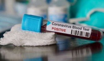 Bilan COVID-19 de la semaine du 27 F&eacute;vrier-05 Mars 2022