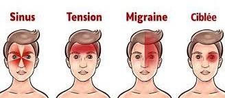 C&eacute;phal&eacute;e de tension: psychog&egrave;ne