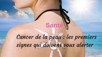 Cancer de la peau