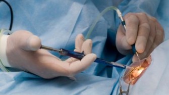 Acc&egrave;s &agrave; la chirurgie de la cataracte,  encore un exemple d&rsquo;in&eacute;galit&eacute; hommes/femmes !